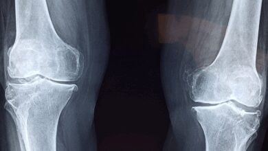 Approaches to Address Pain Beyond Painkillers Approaches to Address Pain Beyond Painkillers